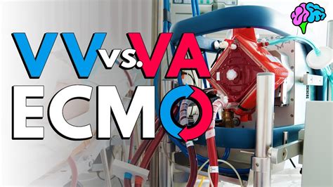 va ecmo vs vv